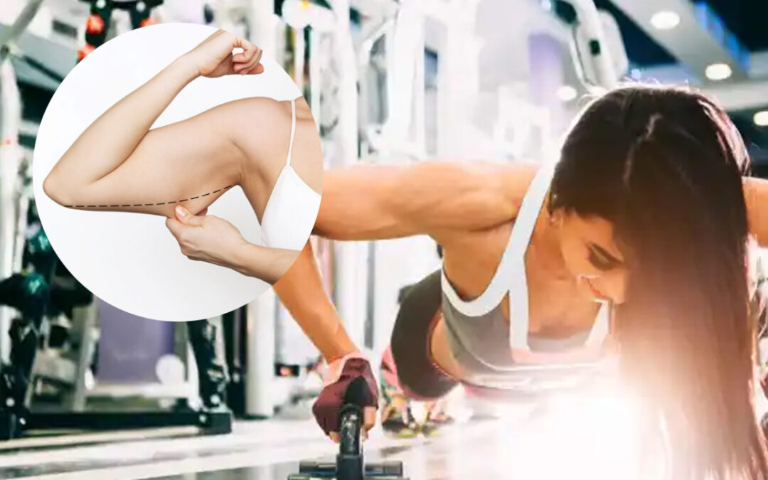 Chicas: ¿cómo evitar los “brazos de murciélago”?