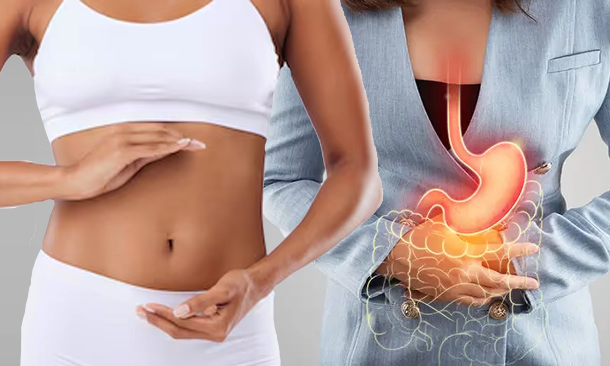 REFLUJO REFLUJO ACIDO