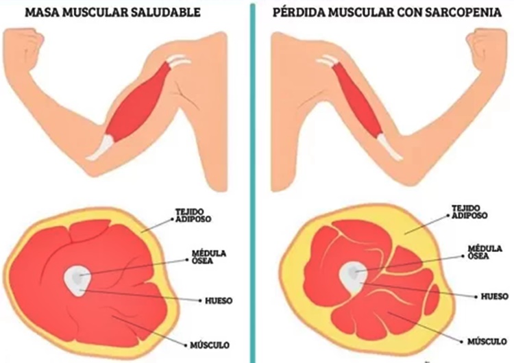 mantener masa muscular es clave para envejecer bien